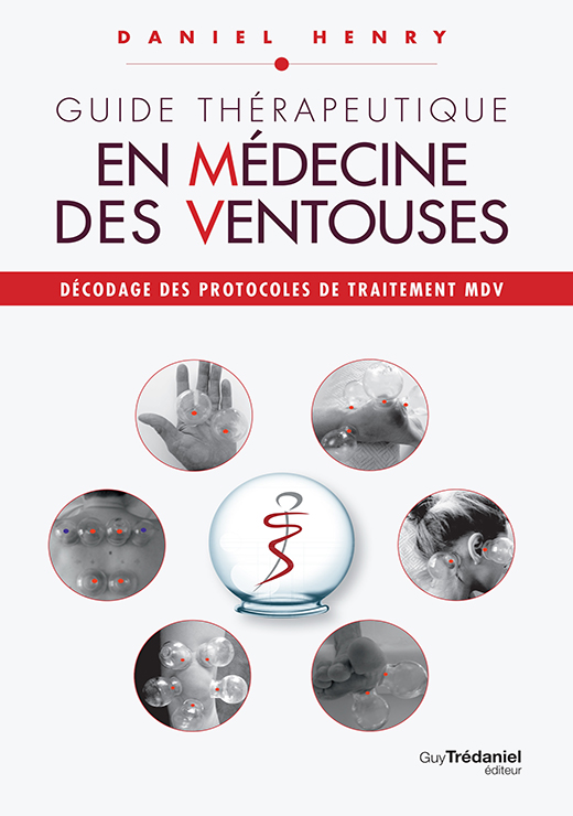 Guide Thérapeutique en Médecine des Ventouses